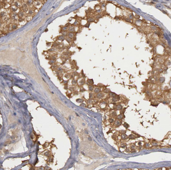 ATP6V1C2 Rabbit Polyclonal Antibody