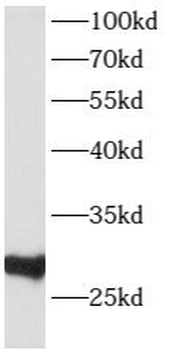 ATP6V1D Rabbit Polyclonal Antibody