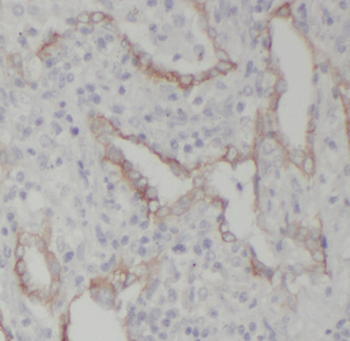 ATP6V1D Rabbit Polyclonal Antibody