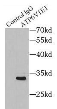 ATP6V1E1 Antibody