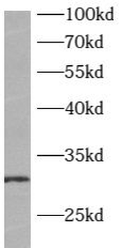 ATP6V1E2 Antibody