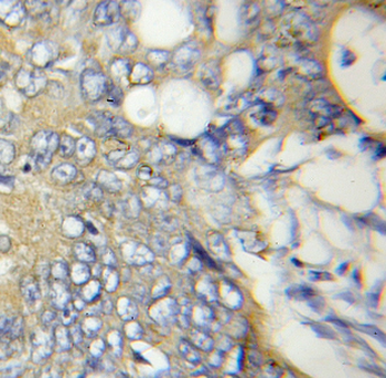 ATPAF2 Rabbit Polyclonal Antibody