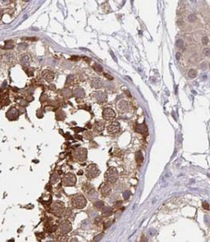 ATXN2L Rabbit Polyclonal Antibody