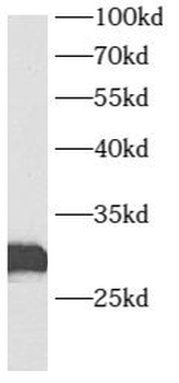 AUH Antibody