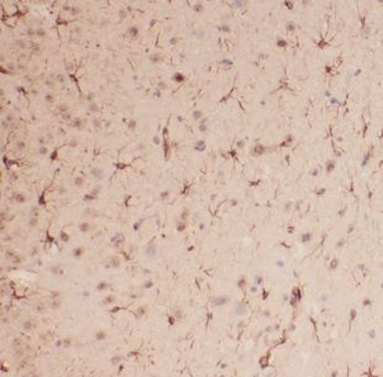 AUH Rabbit Polyclonal Antibody