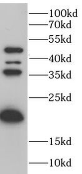 AURKB Rabbit Polyclonal Antibody
