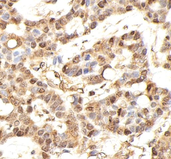 AURKB Rabbit Polyclonal Antibody