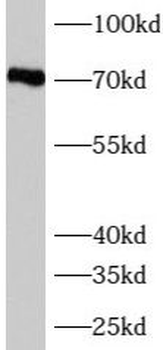 AUTS2 Antibody