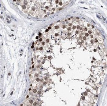 AUTS2 Rabbit Polyclonal Antibody