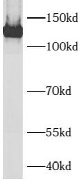 AXL Rabbit Polyclonal Antibody