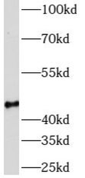 AZI2 Rabbit Polyclonal Antibody