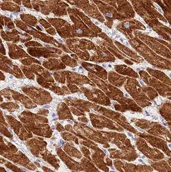 B3GALNT1 Rabbit Polyclonal Antibody