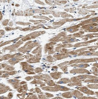 B3GALNT2 Rabbit Polyclonal Antibody
