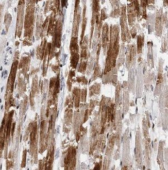 B3GALT2 Rabbit Polyclonal Antibody