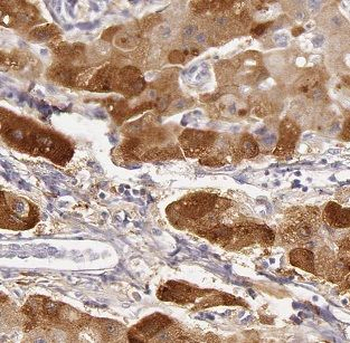 B3GALT6 Rabbit Polyclonal Antibody