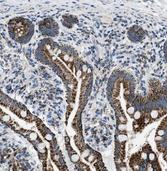 B3GNT3 Rabbit Polyclonal Antibody