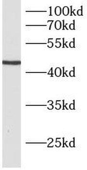 B3GNT5 Antibody