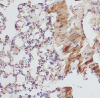 B3GNT5 Rabbit Polyclonal Antibody