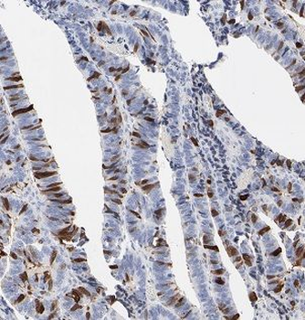 B3GNT7 Rabbit Polyclonal Antibody