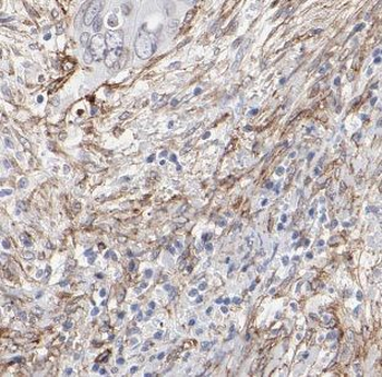 B4GALNT2 Rabbit Polyclonal Antibody