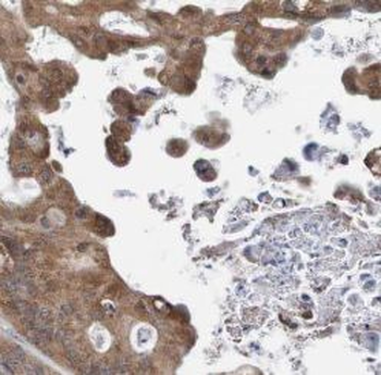 BAIAP2L1 Antibody