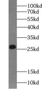 BAK1 Antibody