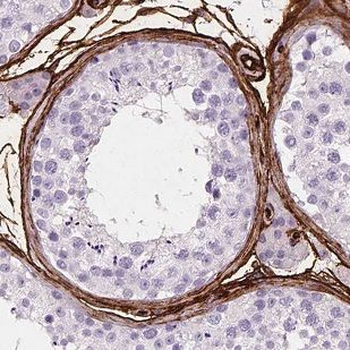 BARHL2 Rabbit Polyclonal Antibody