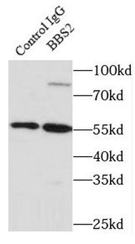 BBS2 Antibody