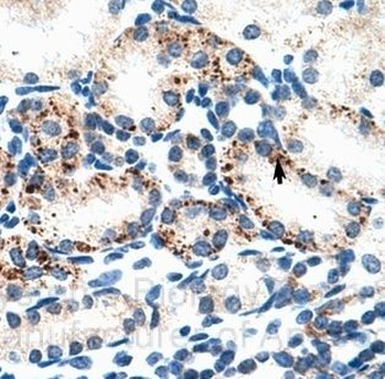 BBS4 Rabbit Polyclonal Antibody