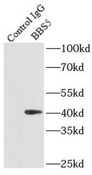 BBS5 Antibody