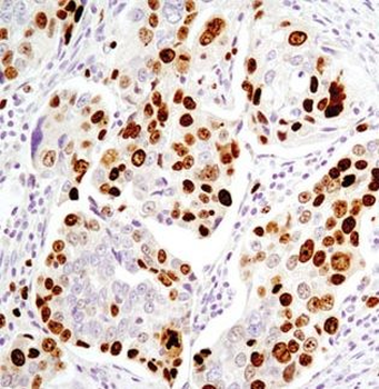 BBX Rabbit Polyclonal Antibody