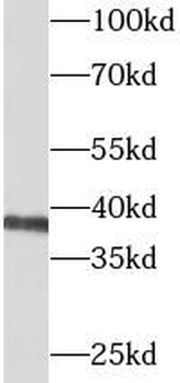 BCAT2 Antibody