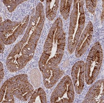 BCL7B Rabbit Polyclonal Antibody