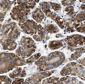 BCO2 Rabbit Polyclonal Antibody