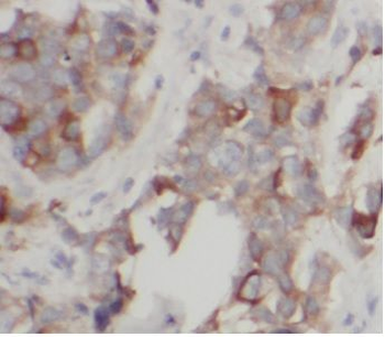ABCG2 Rabbit Polyclonal Antibody