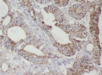 BECN1 Rabbit Polyclonal Antibody