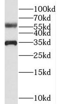 BEND4 Rabbit Polyclonal Antibody