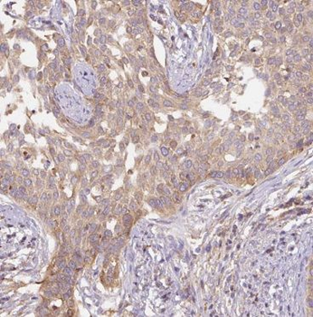 BET1L Antibody
