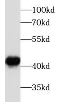 beta actin Antibody