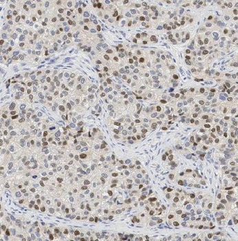 BEX2 Rabbit Polyclonal Antibody