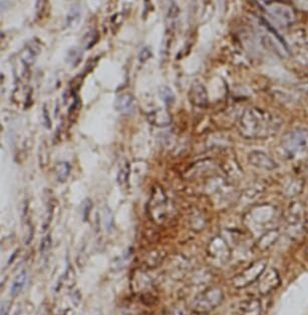 BID Rabbit Polyclonal Antibody