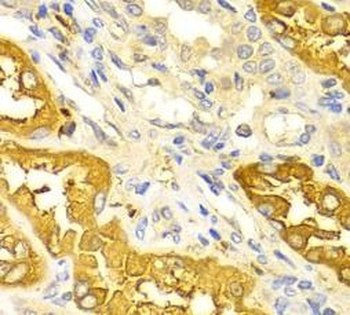 BIN1 Rabbit Polyclonal Antibody
