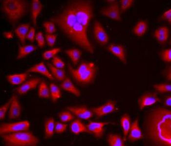 BLMH Antibody
