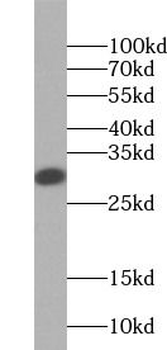 BLVRA Rabbit Polyclonal Antibody