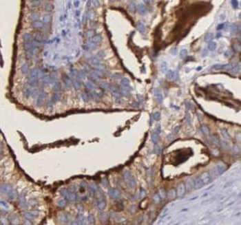BLVRA Rabbit Polyclonal Antibody