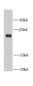 BLVRB Rabbit Polyclonal Antibody
