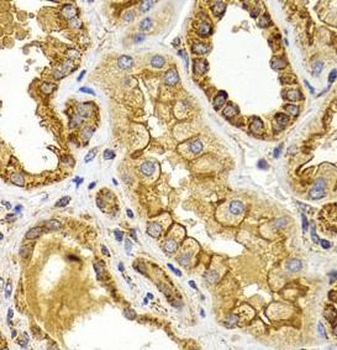 BMP15 Rabbit Polyclonal Antibody