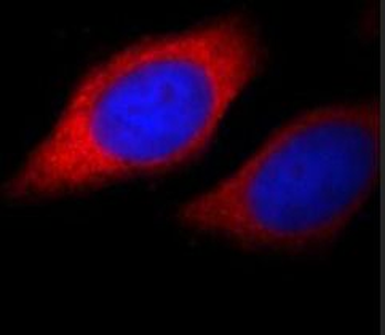 BMPR1A Antibody
