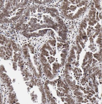 CTCFL Rabbit Polyclonal Antibody