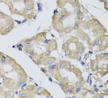 BPGM Rabbit Polyclonal Antibody